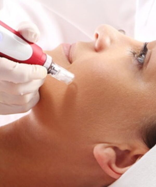 Curso Microagulhamento de Estetica